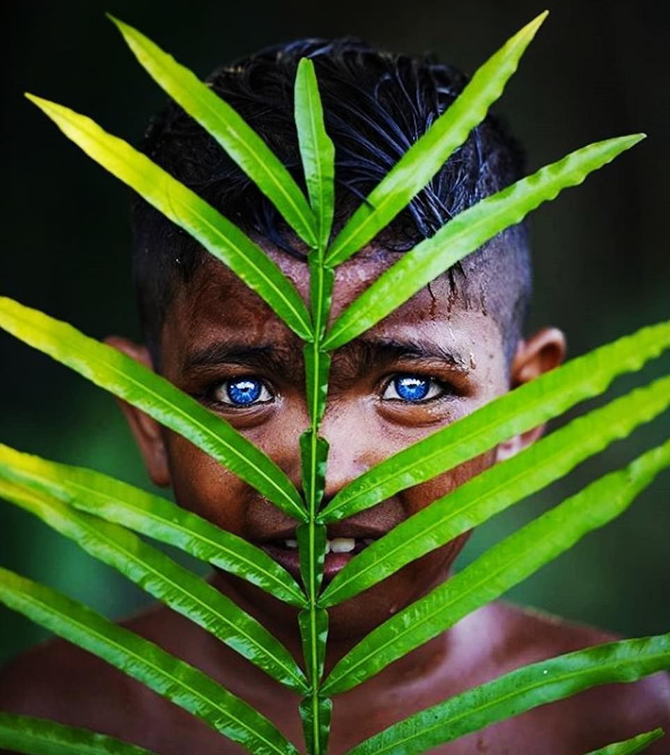سندرم واوردنبورگ، عامل اصلی رنگ آبی چشم